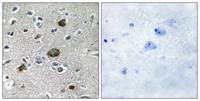 AKAP 149 Polyclonal Antibody