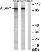 AKAP 149 Polyclonal Antibody
