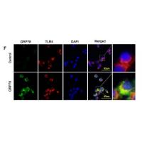 GRP78 BiP Polyclonal Antibody