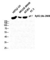 RyR-2 Polyclonal Antibody