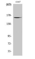 GTBP Polyclonal Antibody