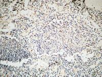 GTBP Polyclonal Antibody