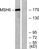 GTBP Polyclonal Antibody