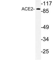 ACE2 Polyclonal Antibody
