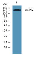 ACINU Polyclonal Antibody