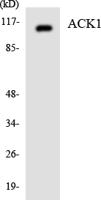 ACK Polyclonal Antibody