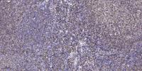 ACK Polyclonal Antibody