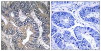 GTPBP2 Polyclonal Antibody