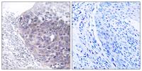 GTPBP5 Polyclonal Antibody