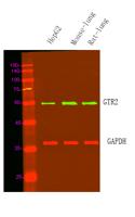 GTR2 Polyclonal Antibody