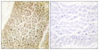 AKAP 95 Polyclonal Antibody