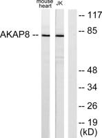 AKAP 95 Polyclonal Antibody