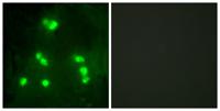 Hairless Polyclonal Antibody