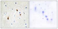 Hairless Polyclonal Antibody