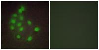 HAND1 Polyclonal Antibody