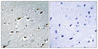 HAND1 Polyclonal Antibody