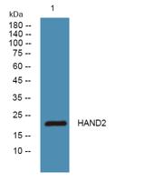 HAND2 Polyclonal Antibody