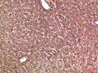Haptoglobin Polyclonal Antibody