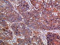 Haptoglobin Polyclonal Antibody