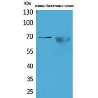 AFP Polyclonal Antibody