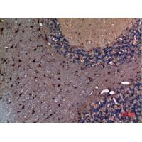 AFP Polyclonal Antibody