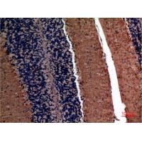 AFP Polyclonal Antibody