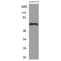 AFP Polyclonal Antibody