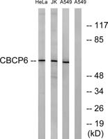 AGBL4 Polyclonal Antibody