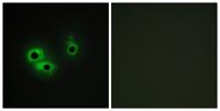 AGR3 Polyclonal Antibody