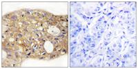 AGR3 Polyclonal Antibody