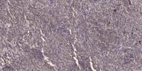 AGS3 Polyclonal Antibody