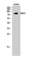 HBO1 Polyclonal Antibody