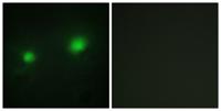 HBO1 Polyclonal Antibody