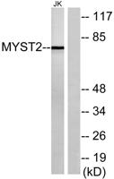 HBO1 Polyclonal Antibody
