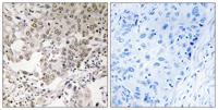 hCAP-G2 Polyclonal Antibody