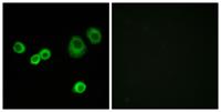 HCCS Polyclonal Antibody