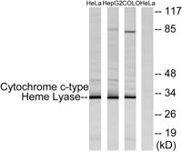 HCCS Polyclonal Antibody