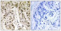 HCF1 Polyclonal Antibody