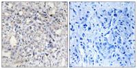 HC-II Polyclonal Antibody