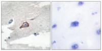 Hck Polyclonal Antibody