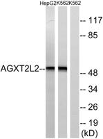 AGXT2L2 Polyclonal Antibody