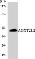 AGXT2L2 Polyclonal Antibody