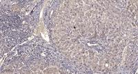 AGXT2L2 Polyclonal Antibody