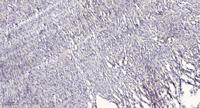 AHA-1 Polyclonal Antibody