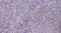 AHNK Polyclonal Antibody
