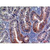 AID Polyclonal Antibody
