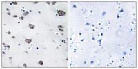 AIFL Polyclonal Antibody
