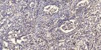 AIF-M1 Polyclonal Antibody