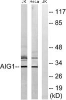 AIG-1 Polyclonal Antibody