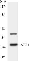 AIG-1 Polyclonal Antibody